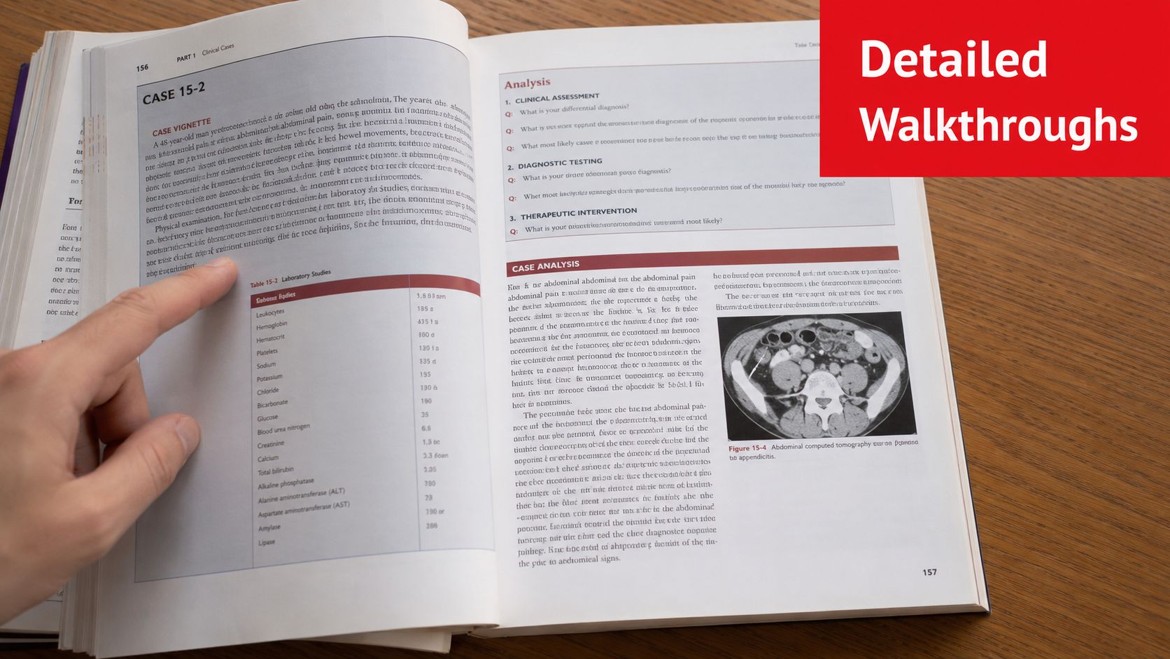 A hand pointing at a medical textbook page about clinical case 15-2 on abdominal pain and diagnostic tests.