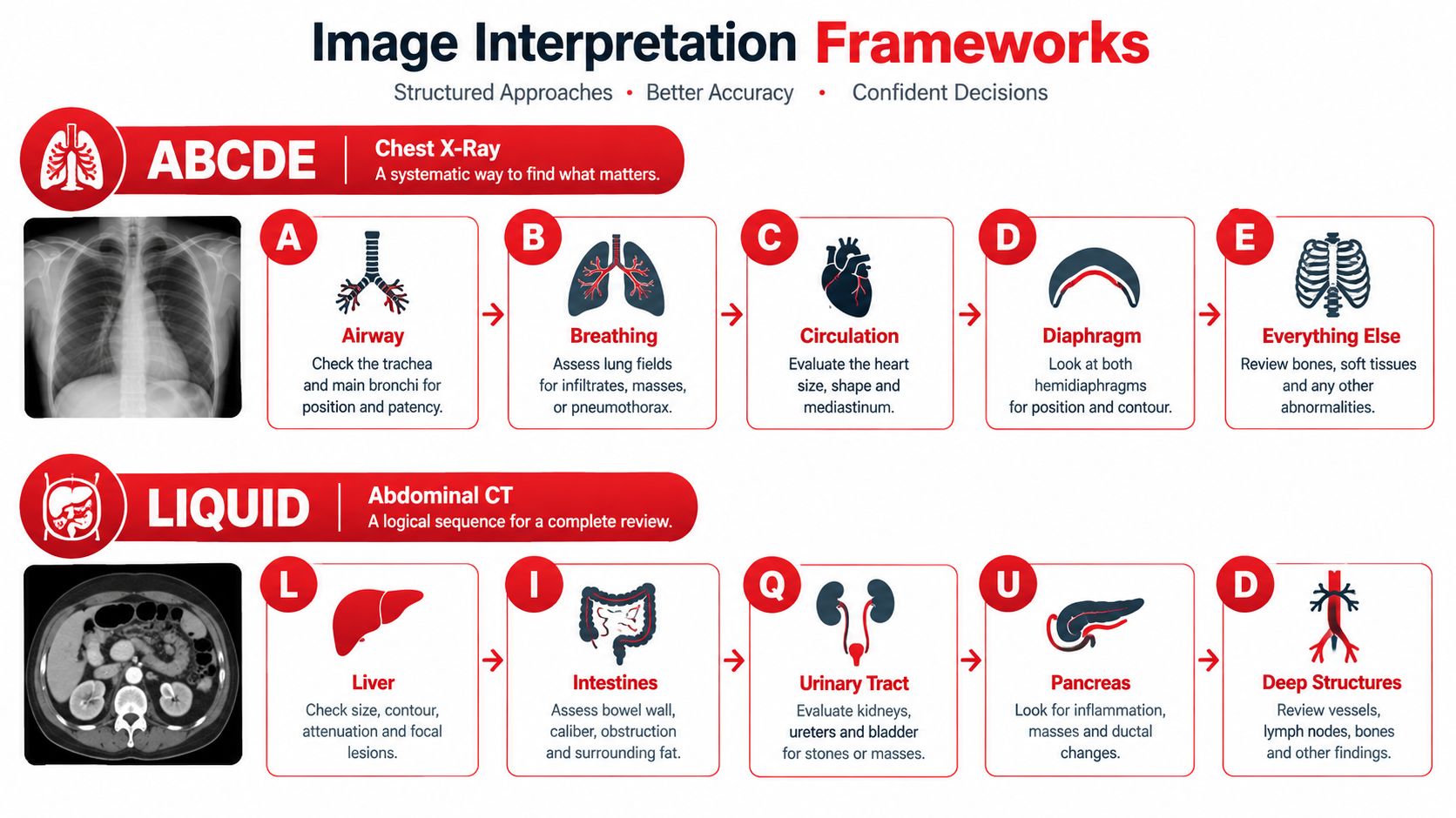 An infographic showing systematic frameworks for interpreting medical chest X-rays and abdominal CT scans using acronyms.